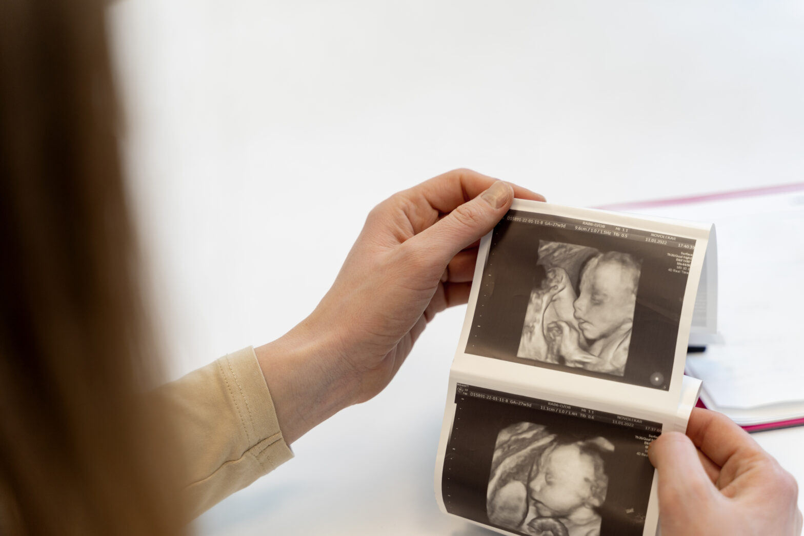 Evolution of Fetal Ultrasound - 2D, 3D, 4D, and 5D - Dr Mamta Phogat